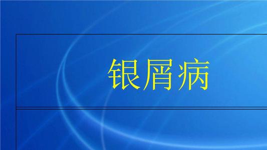 u=44471799,3754578273&fm=26&gp=0.jpg